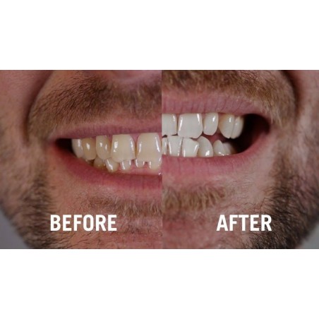 Gel Albire Dinti Dr. George’s Dental White – tub 148gr (mulaje incluse)