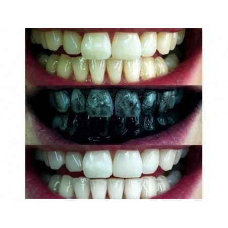 Glory Smile Natural Teeth Whitening Powder with activated charcoal - 30gr