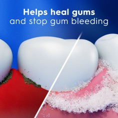 Pasta de Dinti, Crest, Pro-Health, Enamel Repair and Gum, Advanced Whitening, Efect de Albire si Reparare a Smaltului Slabit, Pr 2
